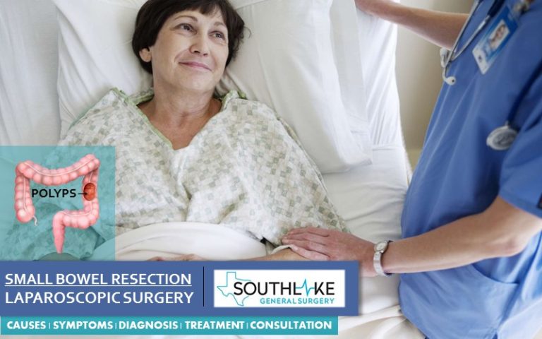 Small Bowel Resection Archives Southlake General Surgery 9784