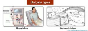 Define Dialysis- Peritoneal Dialysis vs Hemodialysis, Complications of PD