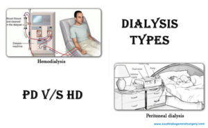 dialysis peritoneal hemodialysis complications