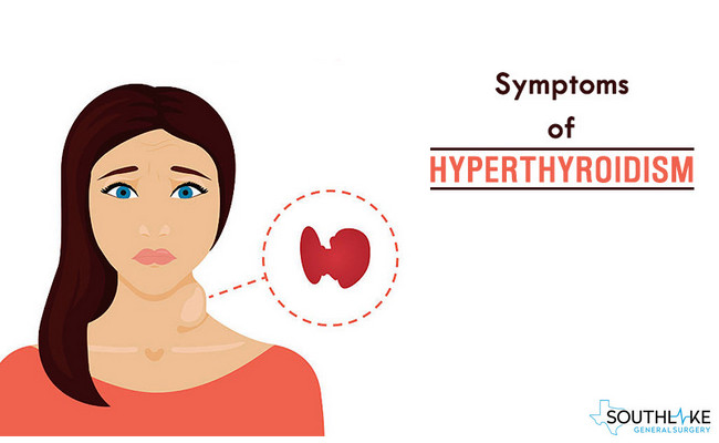 Hyperthyroidism Causes Symptoms Treatment Hyperthyroidism Bank Home Com