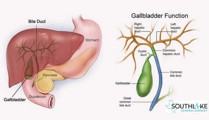 Gallbladder Surgery Side Effects Recovery Southlake General Surgery