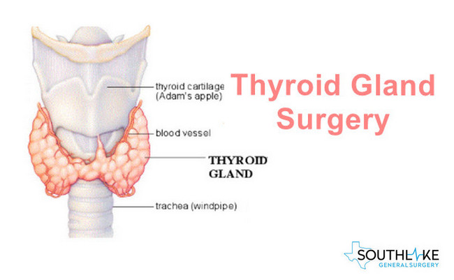 Surgical Removal Of The Parathyroid Glands Doctorvisit