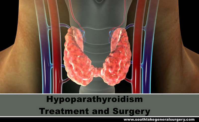 hypoparathyroidism signs and symptoms