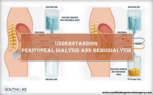 Peritoneal Dialysis vs Hemodialysis - Southlake General Surgery