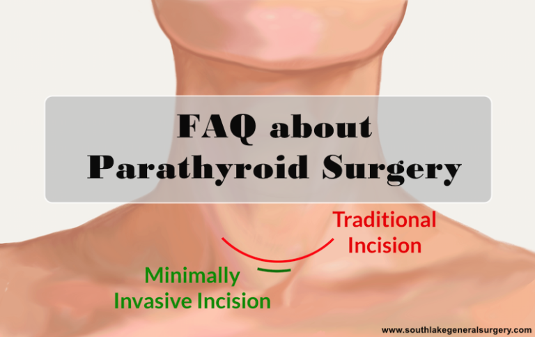 parathyroid-surgery-video-medical-video-library