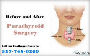 parathyroid surgery valeria