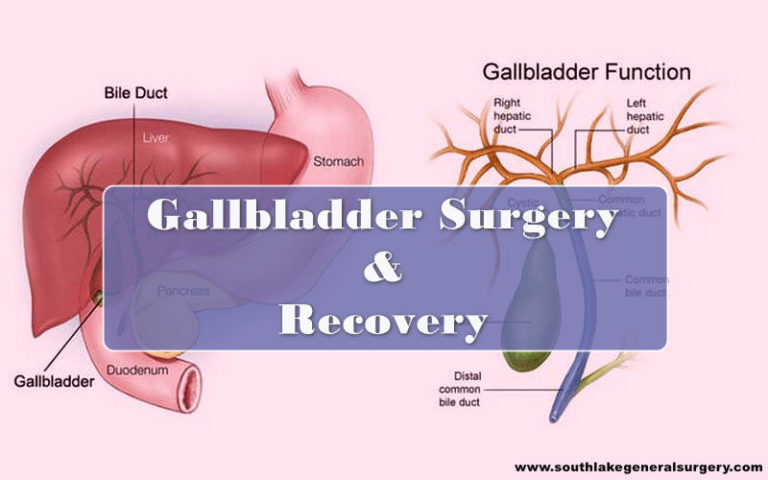 Gallbladder Removal Surgery - Complications and Recovery