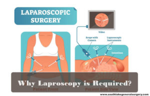 Laparoscopic Surgery and Recovery - Southlake General Surgery