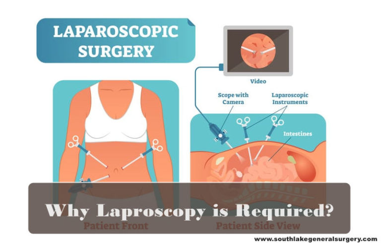 diagnostic-laparoscopy