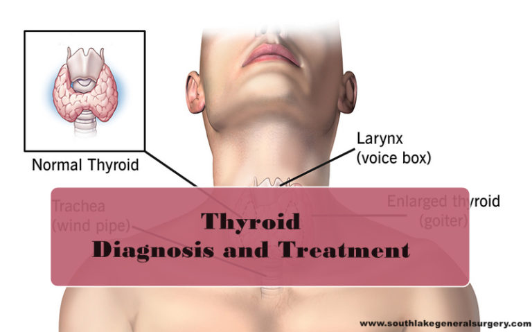 Thyroid Removal Surgery Hospital Southlake Texas Best Thyroid Surgeon