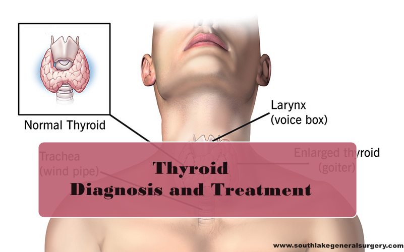 Thyroid Problem Diagnosis And Treatment Southlake General Surgery