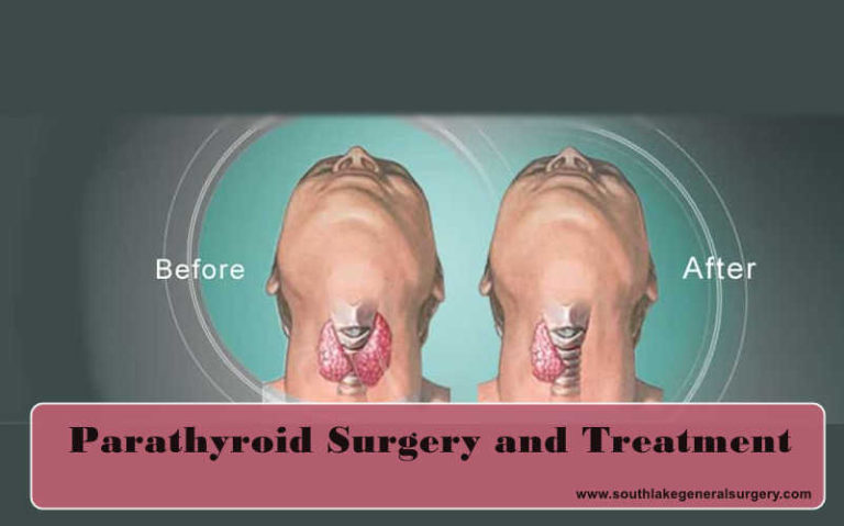 parathyroid-diseases-and-treatments-southlake-southlake-general-surgery