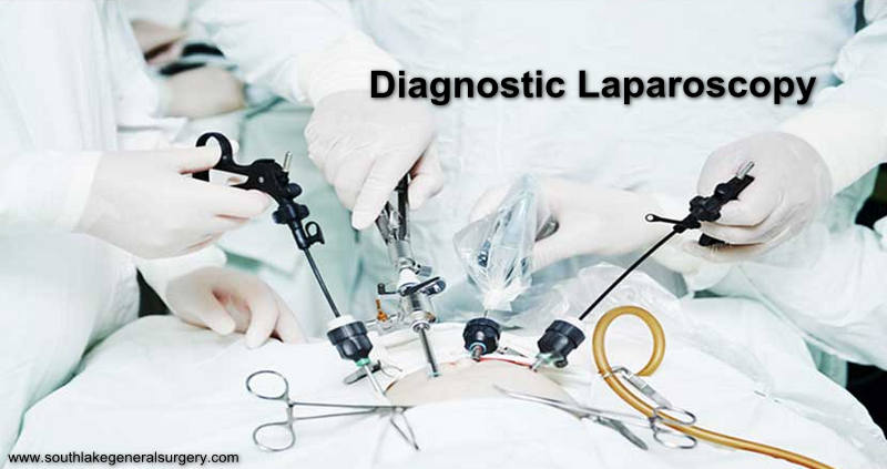 Diagnostic-laparoscopy Southlake