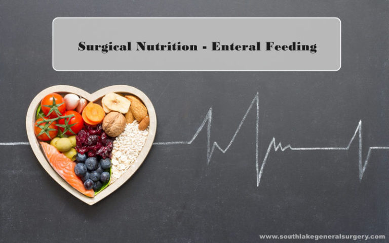 Surgical Nutrition - Enteral Feeding: How Does It Function And When To ...