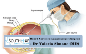 Dr Valeria Simone (MD)- Experienced General Surgeon, Southlake, Texas