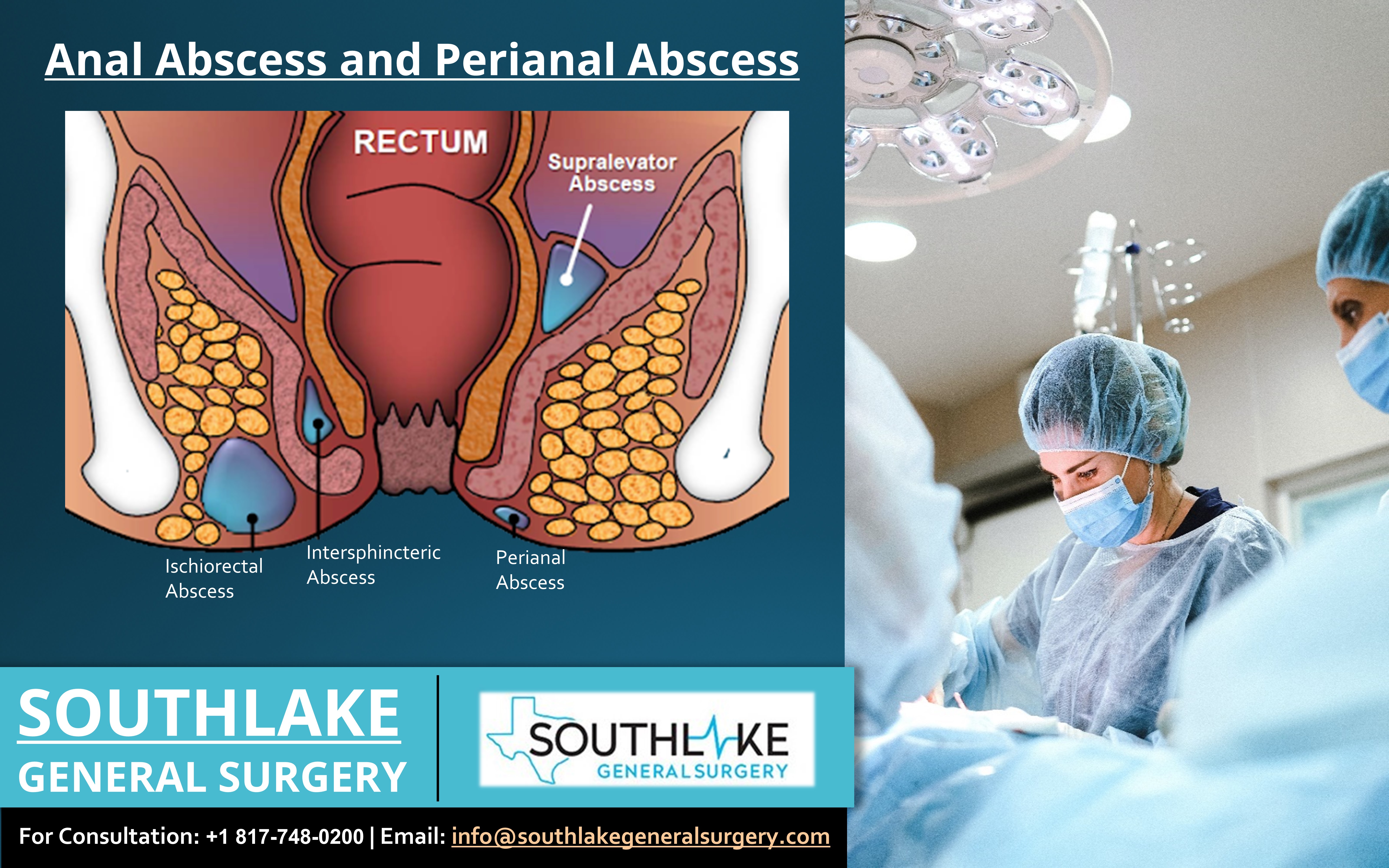 perirectal abscess