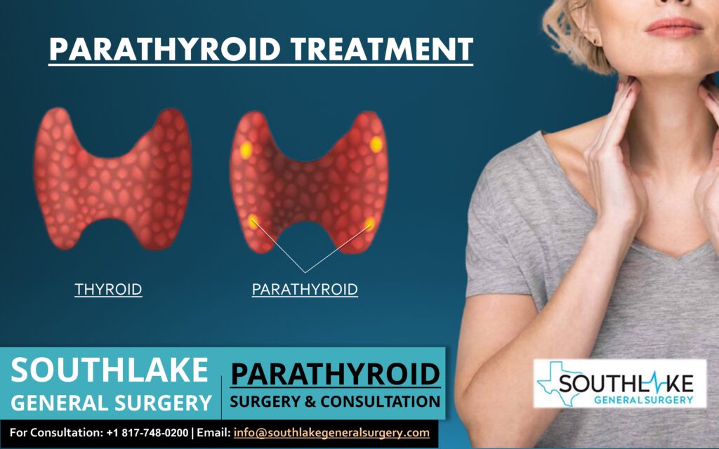 parathyroid-treatment-and-consultation-southlake-general-surgery