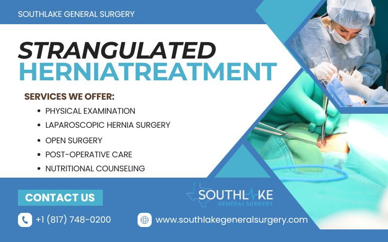 illustration of a surgeon performing Strangulated hernia treatment at Southlake General Surgery