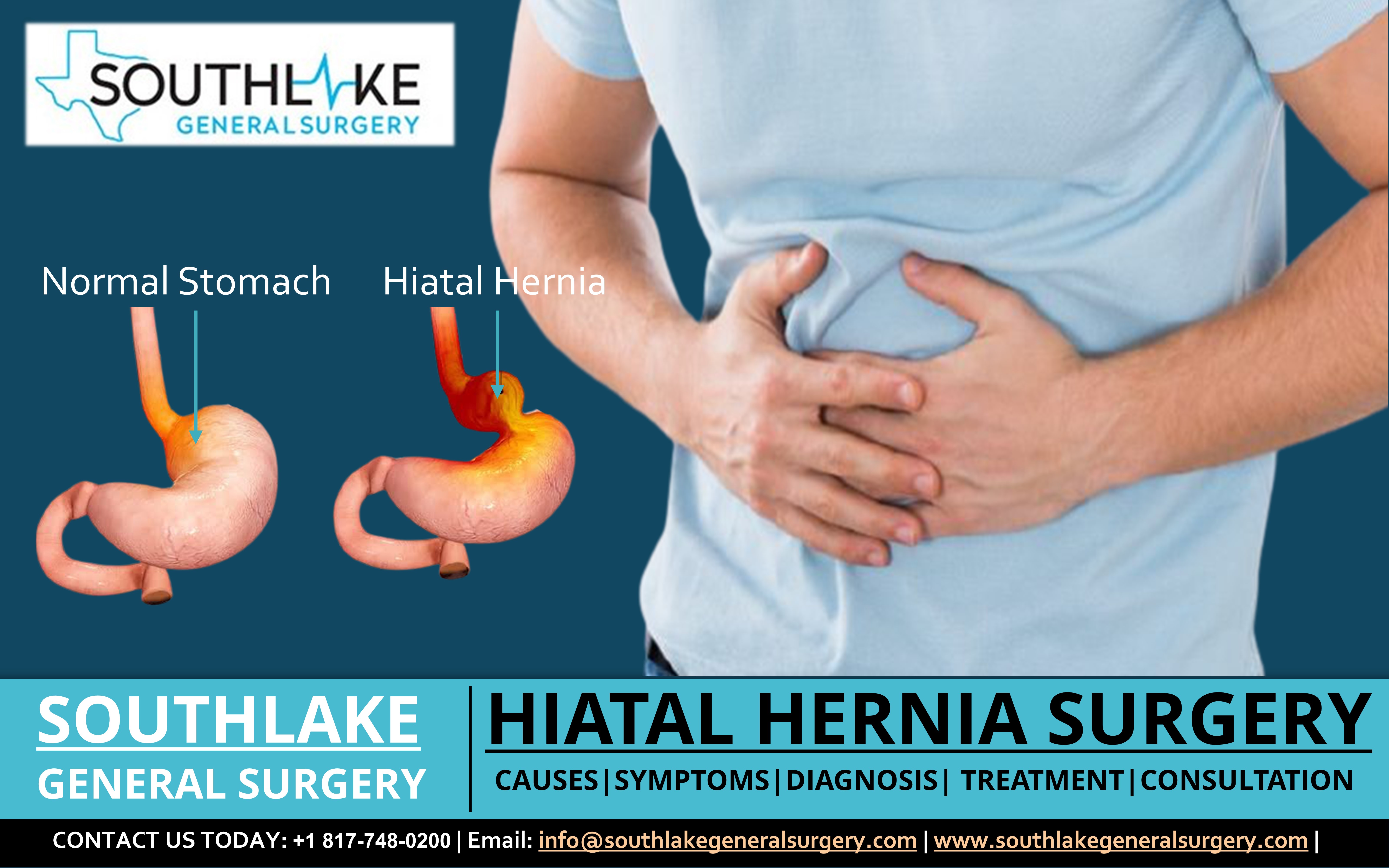 Ventral Hernia Treatment - Southlake General Surgery