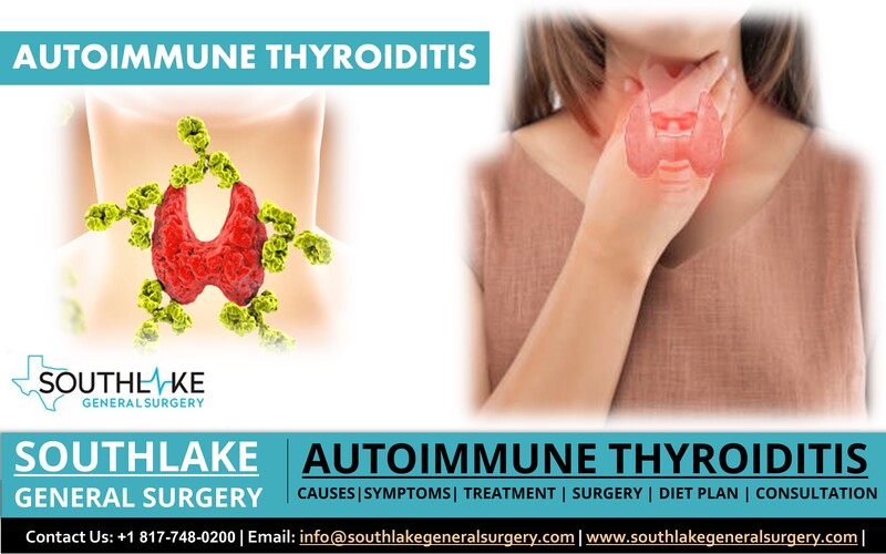 Autoimmune Thyroiditis - Causes, Symptoms, Diagnosis and Treatment