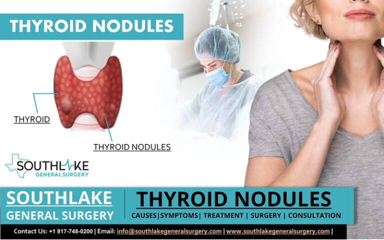 thyroid-nodules-symptoms-treatment-and-surgery-southlake-general