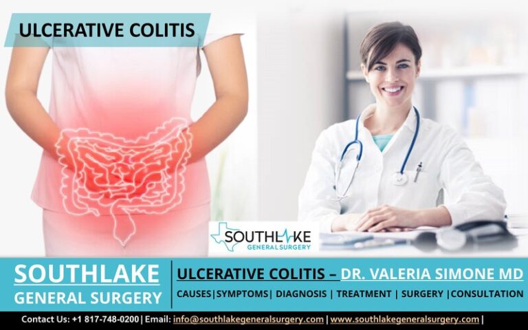 Ulcerative Colitis – Diagnosis, Treatment, And Surgery