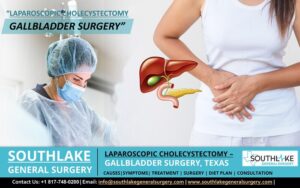 Laparoscopic Cholecystectomy (Gallbladder Surgery, Texas) - Southlake ...