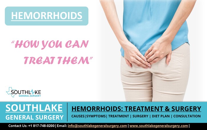 Hemorrhoids are swollen veins in the anus or rectum also known as piles. Contact our Healthcare Expert Today at +1(817) 748-0200.