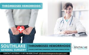 Thrombosed Hemorrhoids – Southlake General Surgery