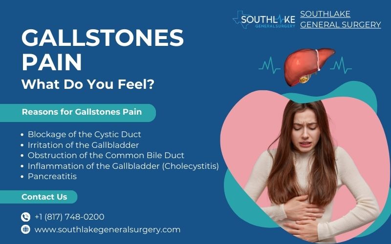 Gallstones Pain – What Do You Feel