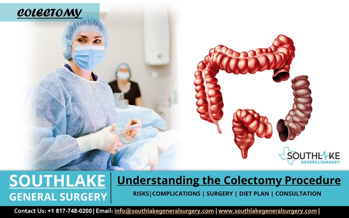 total abdominal colectomy