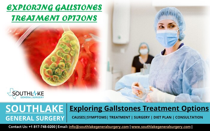 Exploring Gallstones Treatment Options