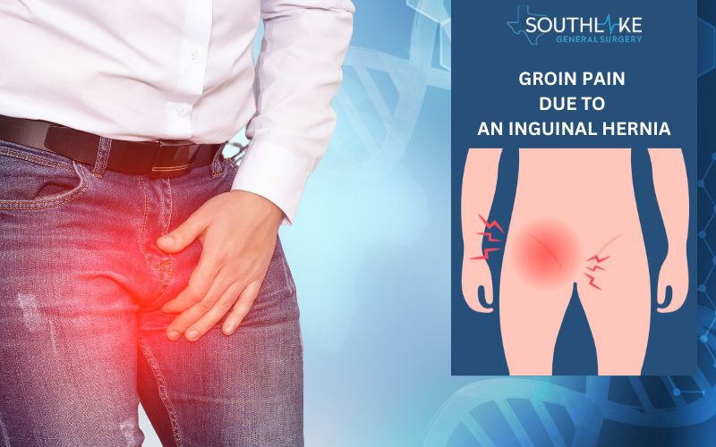 https://www.southlakegeneralsurgery.com/wp-content/uploads/2023/09/A-person-experiencing-groin-pain-due-to-an-inguinal-hernia.jpg