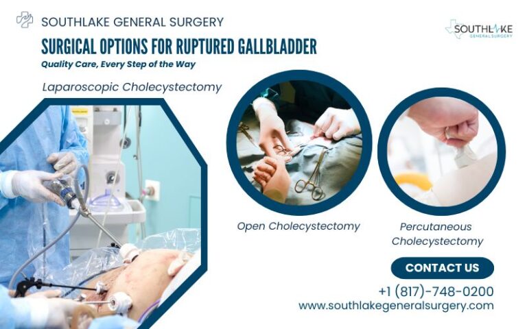 Surgical Options For Ruptured Gallbladder Southlake General Surgery 3278