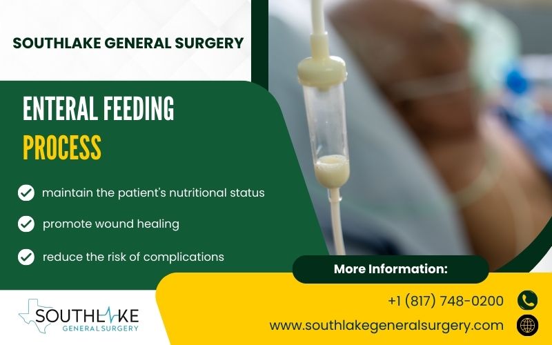 Visual representation of the enteral feeding process under Surgical nutrition, depicting the administration of nutrients through feeding tubes.