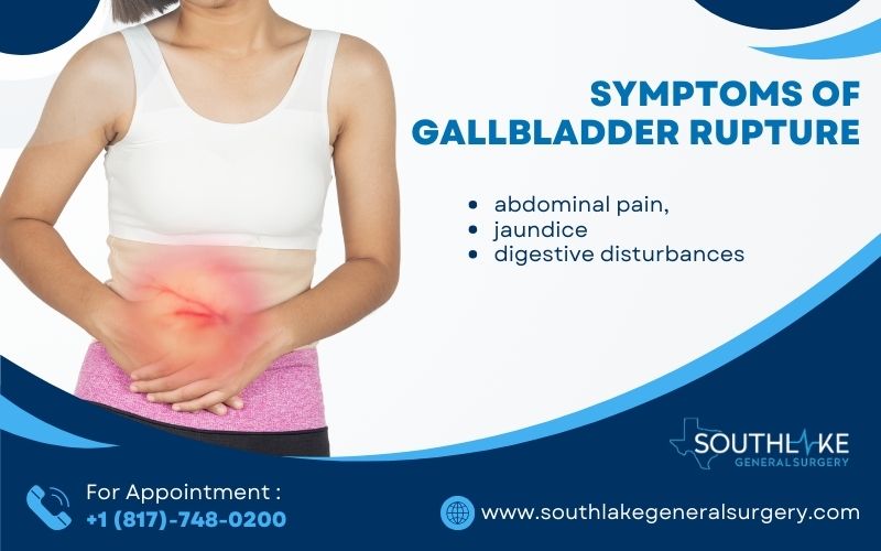 Surgical Options for Ruptured Gallbladder - Southlake General Surgery