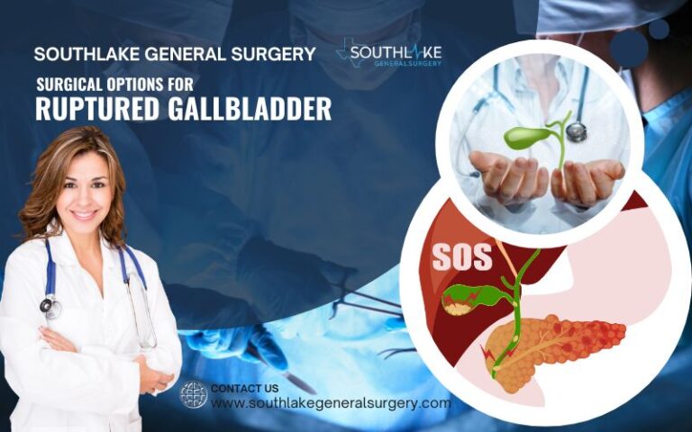 Surgical Options For Ruptured Gallbladder Southlake General Surgery 7197