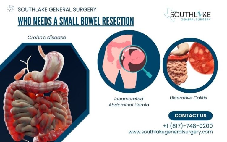 Understanding Small Bowel Resection Southlake General Surgery