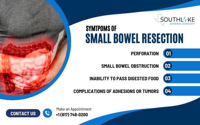 Understanding Small Bowel Resection - Southlake General Surgery