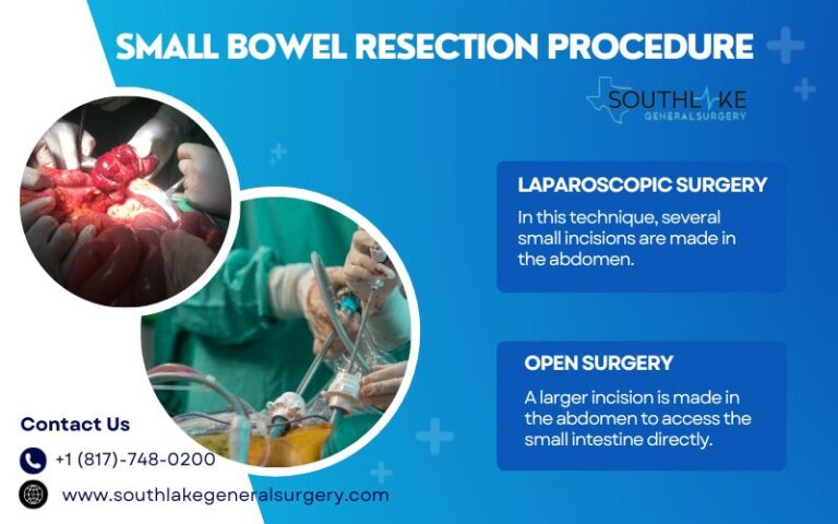 Understanding Small Bowel Resection - Southlake General Surgery