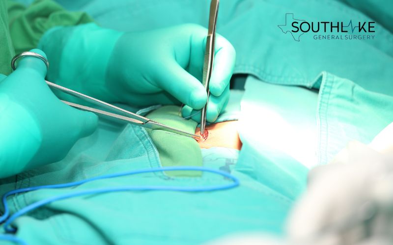 Image of a surgeon performing hernia repair surgery