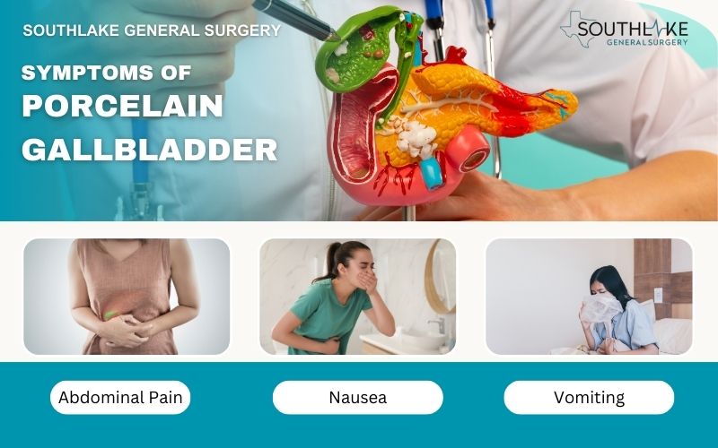 Collage illustrating common symptoms of porcelain gallbladder abdominal pain, nausea, and vomiting