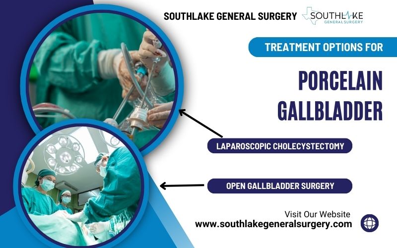 Comparison graphic showing laparoscopic cholecystectomy (minimally invasive) versus open surgery for gallbladder removal.