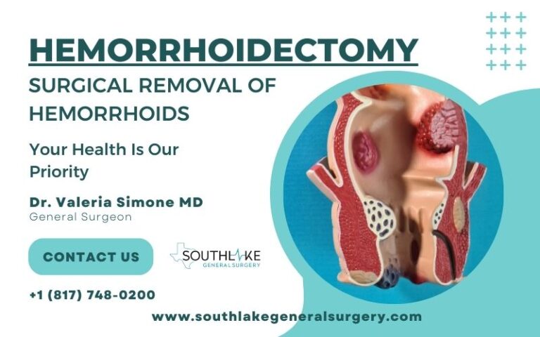 Hemorrhoidectomy Surgical Removal Of Hemorrhoids Procedure Southlake General Surgery