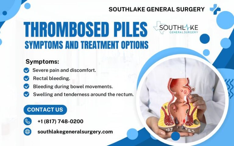 Thrombosed Piles Symptoms And Treatment Guide Southlake General Surgery