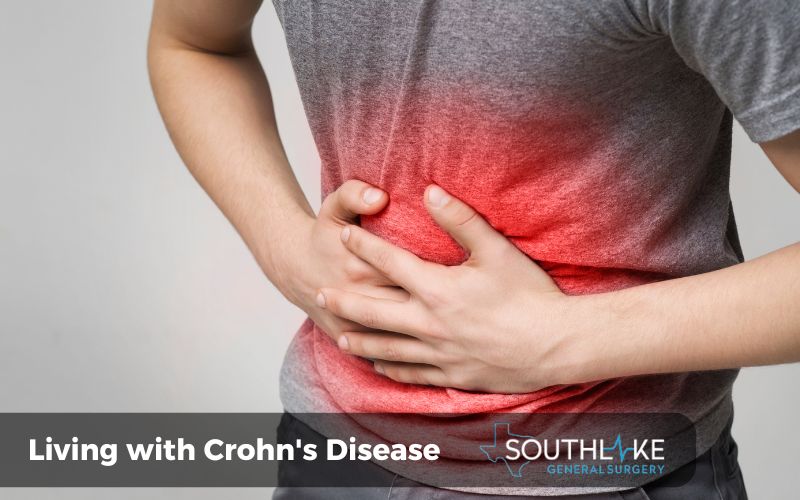 A person holding their stomach in pain due to Crohn's disease.