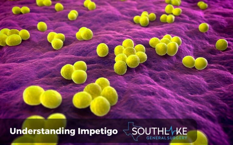 Impetigo Infection: Essential Prevention & Treatment - Southlake ...