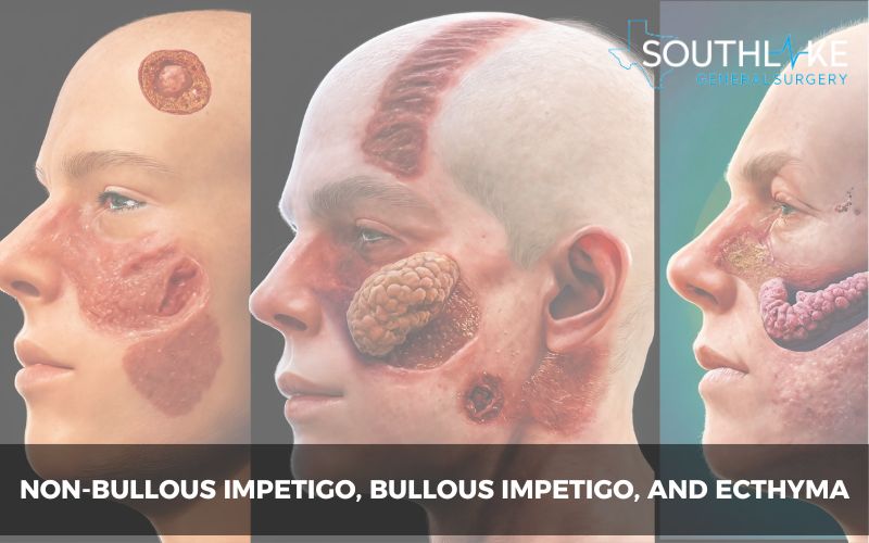 Comparison images showing non-bullous impetigo, bullous impetigo, and ecthyma.