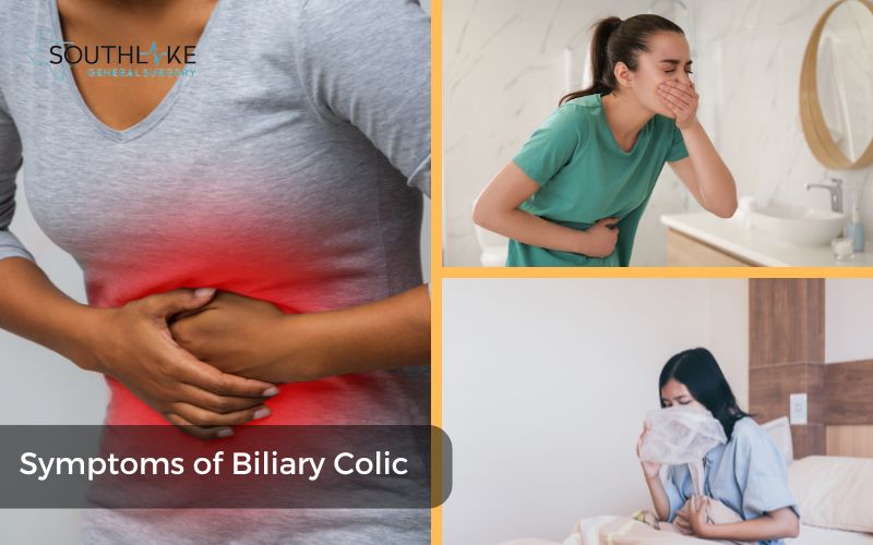 Biliary Colic Pain: Expert Tips - Southlake General Surgery