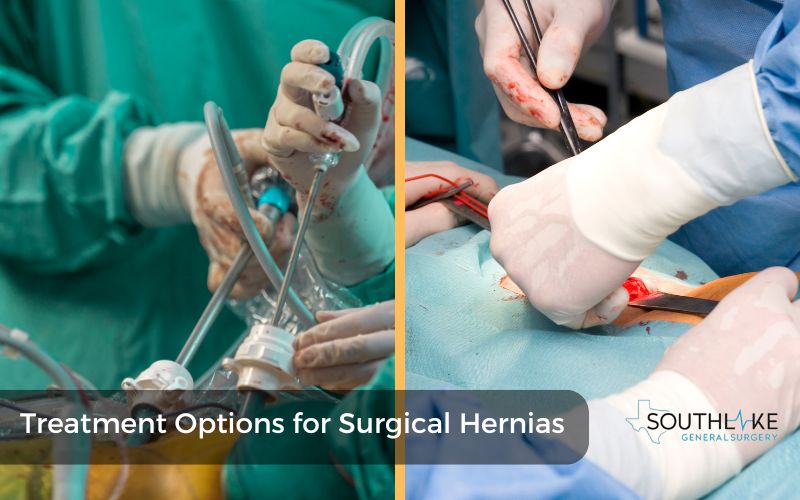 Comparison between laparoscopic hernia repair and open surgery techniques.